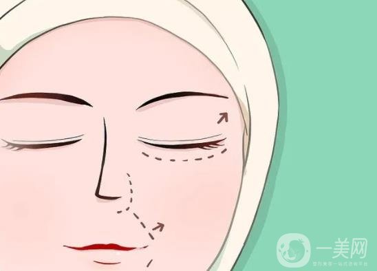 眼*整形全过程跟踪及术后恢复日记