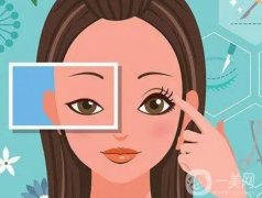 割双眼皮什么年龄是适合的？