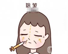 玻尿酸的去皱果能持续多长时间？