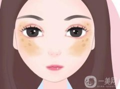 的种类有哪些？