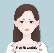 割双眼皮后怎么做能够很快恢复?
