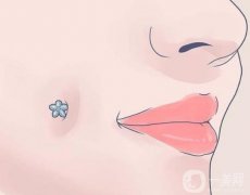 酒窝形成的原因和人造酒窝的方法