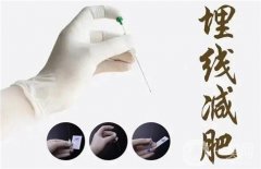 埋线减肥能瘦全身吗？埋线减肥快吗