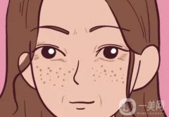 去除斑点疼吗？