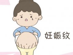 激光去除妊娠纹真的有吗？有什么果？
