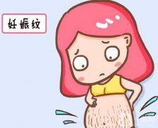 去除妊娠纹有哪些方法？激光去除妊娠纹有什么优势