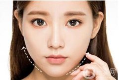 不同脸型条件下的瘦脸方法介绍