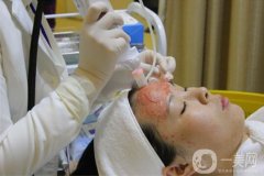 微针可以调节痘疤吗?果怎么样?