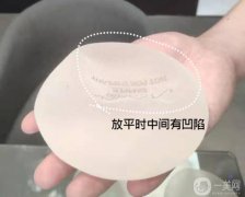 娜绮丽假体隆胸的等级和优点概述