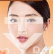 T字3D轮廓整形打造立体夏日下颌线轮廓