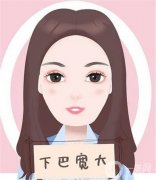 垫下巴有什么优缺点?