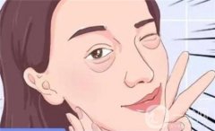 什么是轮廓固定，为什么需要轮廓固定