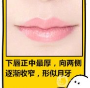 如何区分骨性突嘴还是牙性突嘴