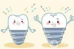 意大利bb种植体有什么优点和缺点