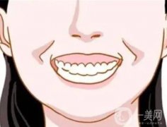 正颌手术方法有哪些?流程解析