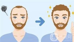 植发技术再突破!取发、无痕植发，让你「植」回自信