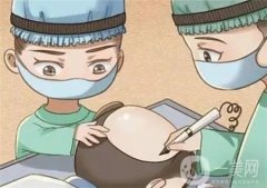 植发后可以烫染吗?植发后如何护理?