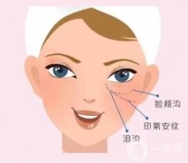 自体脂肪填充泪沟效果能维持多久?有哪些注意事项?效果如何?