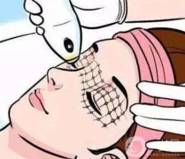 热玛吉VS 欧洲之星Fotona4D有什么不同?哪个才是抗衰神器?