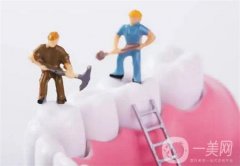 烤瓷牙冠多少钱一颗