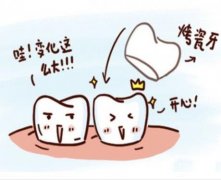 烤瓷牙好还是全瓷牙好