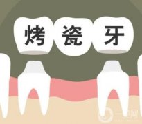 烤瓷牙能做ct和核磁共振检查吗