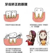 牙齿矫正多大年龄好