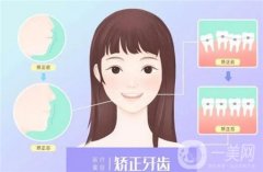 牙齿矫正需要多少钱具体多少价格