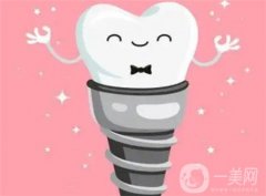 种牙的流程 需要去几次