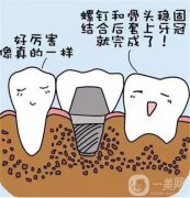 种牙全过程视频