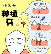 种牙有什么风险和后遗症