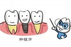 种植牙价格会调控吗_