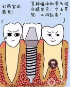 种植牙多少钱一颗医保能报吗