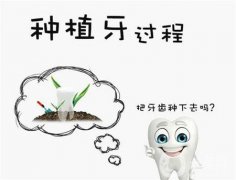 种植牙过程痛吗