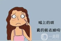 激光祛斑后的注意事项是什么?