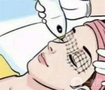 7d和热玛吉哪个提升效果好