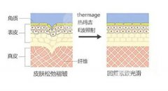 7d聚拉提与热玛吉的区别
