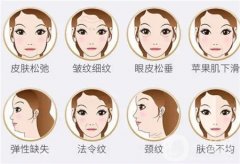 去皱去法令纹什么产品好