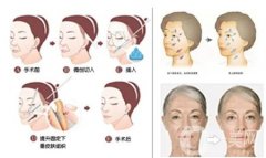 什么方法可以去皱