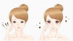 眼睛皱纹严重如何去除（如何去除眼睛皱纹）