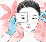 埋线双眼皮怎样快速消肿