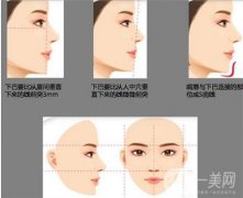 垫下巴手术后肿胀需要多长时间才能消肿