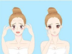 20岁有抬头纹正常吗