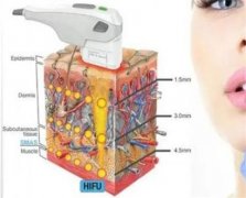 50岁除皱紧肤做什么项目
