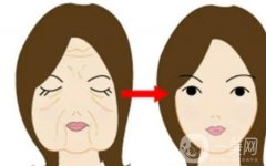 热玛吉五代有什么效果和副作用