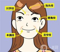 十几岁的女孩为啥有法令纹