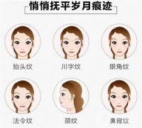 中面部提升除皱术维持多久