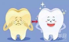 快速解决牙黄的小妙招