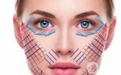 一年做两次线雕对脸有伤害吗？线雕的优点和缺点是什么？