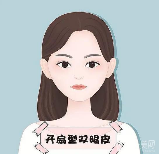 杭州美莱李保锴全切双眼皮术后三个月恢复图